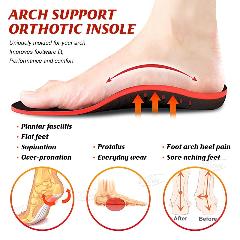 【Xxin】Arch Support Shoe Insoles Flat Foot Correction Pad Cushion Insert Orthopedic Heel Cup Memory Foam Size35-49