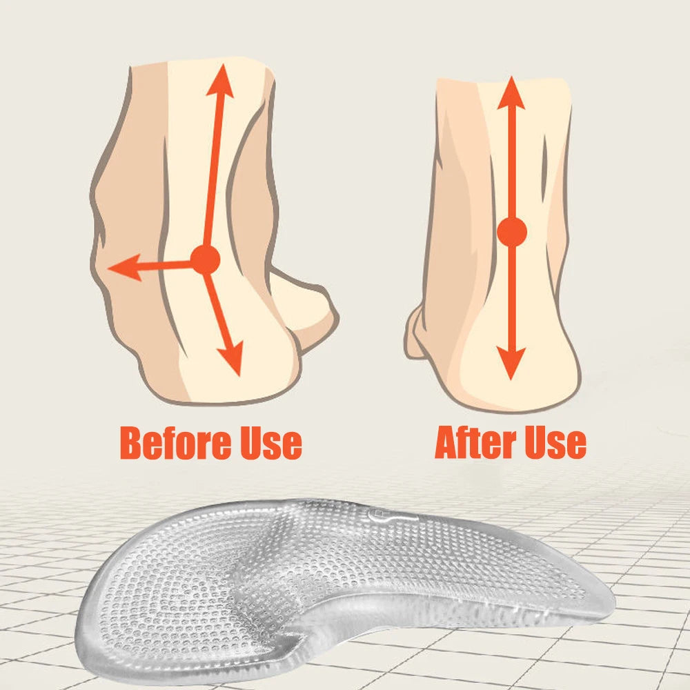 Silicone Gel Orthopedic Insoles for Shoes Women Flat Feet Arch Support Foot Insoles for Plantar Faciitis Pain Relief Shoe Pads