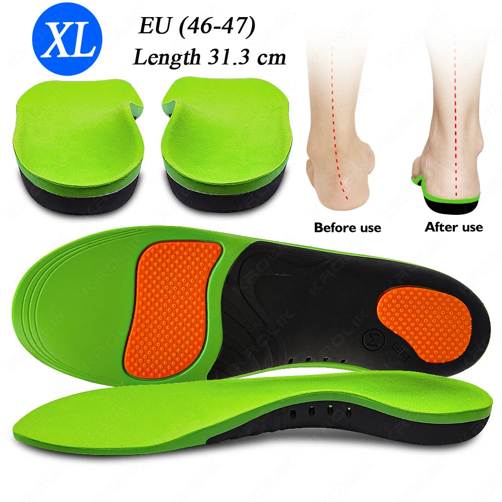 Flat Feet Arch Support X/O Legs Flat Foot Health Shoes Soles Pad Insoles Orthotic Insole for Plantar Fasciitis Orthopedic Unisex