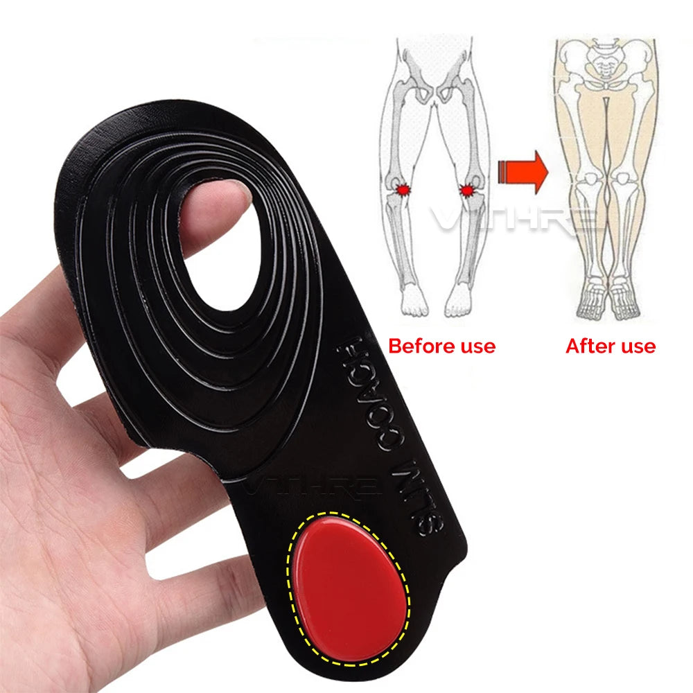 OX Leg Orthotics Cubitus Varus half flat foot Insole Orthopedic Insoles for Shoes insert Arch Support pad for plantar fasciitis