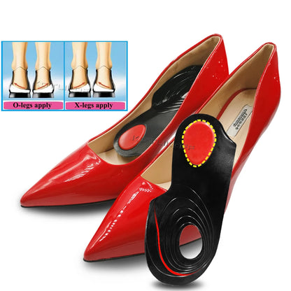 Orthopedic O/X-Leg Legs Relieve Insoles Silicone Soft Self-adhesive Corrector Valgus Varus Relieve Pain Massage Foot Care Insert