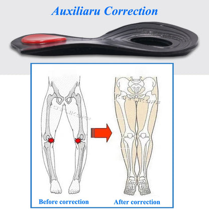 Orthopedic O/X-Leg Legs Relieve Insoles Silicone Soft Self-adhesive Corrector Valgus Varus Relieve Pain Massage Foot Care Insert
