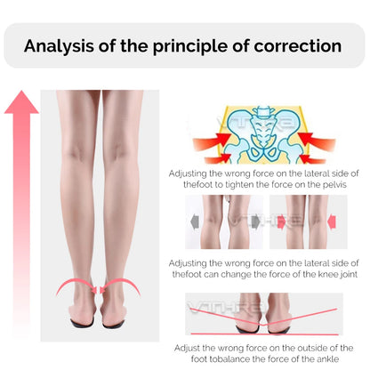 OX Leg Orthotics Cubitus Varus half flat foot Insole Orthopedic Insoles for Shoes insert Arch Support pad for plantar fasciitis