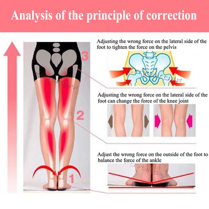 Orthopedic O/X-Leg Legs Relieve Insoles Silicone Soft Self-adhesive Corrector Valgus Varus Relieve Pain Massage Foot Care Insert