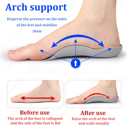 1 Pair Magnetic Orthopedic Insoles Orthotics Flat Sole Pads For Foot Health Shoes Insert  Arch Support Pad For Feet Care Insoles