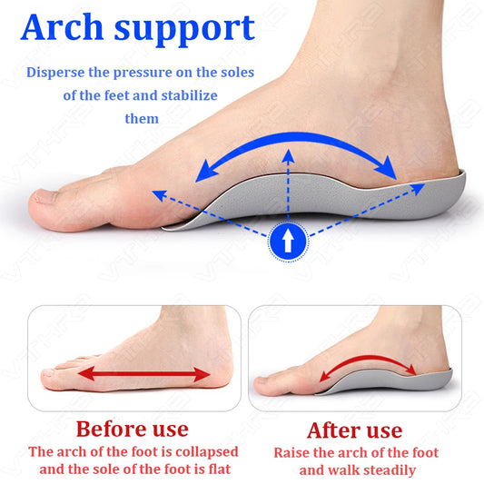 1 Pair Magnetic Orthopedic Insoles Orthotics Flat Sole Pads For Foot Health Shoes Insert  Arch Support Pad For Feet Care Insoles