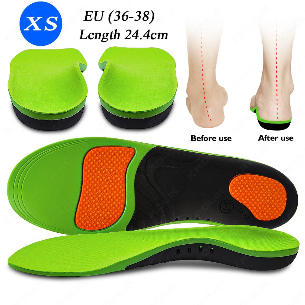 Flat Feet Arch Support X/O Legs Flat Foot Health Shoes Soles Pad Insoles Orthotic Insole for Plantar Fasciitis Orthopedic Unisex