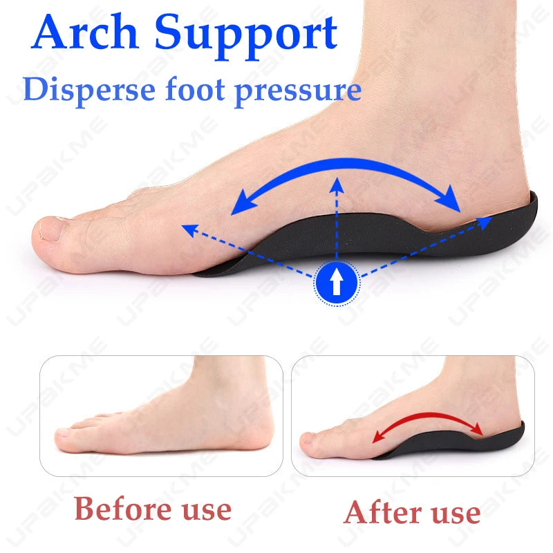 Magnetic Arch Support Insoles Flat Feet Correction Orthotics Overpronation Underpronation Foot Support XO Legs Massage Shoe Pads