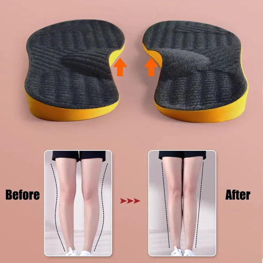 Orthotic Insole Arch Support Flat Foot Orthopedic Insoles for Shoes Women Men X/O Type Legs Valgus Feetn Shoe Pads Deodorization
