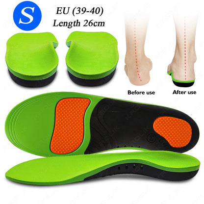Flat Feet Arch Support X/O Legs Flat Foot Health Shoes Soles Pad Insoles Orthotic Insole for Plantar Fasciitis Orthopedic Unisex