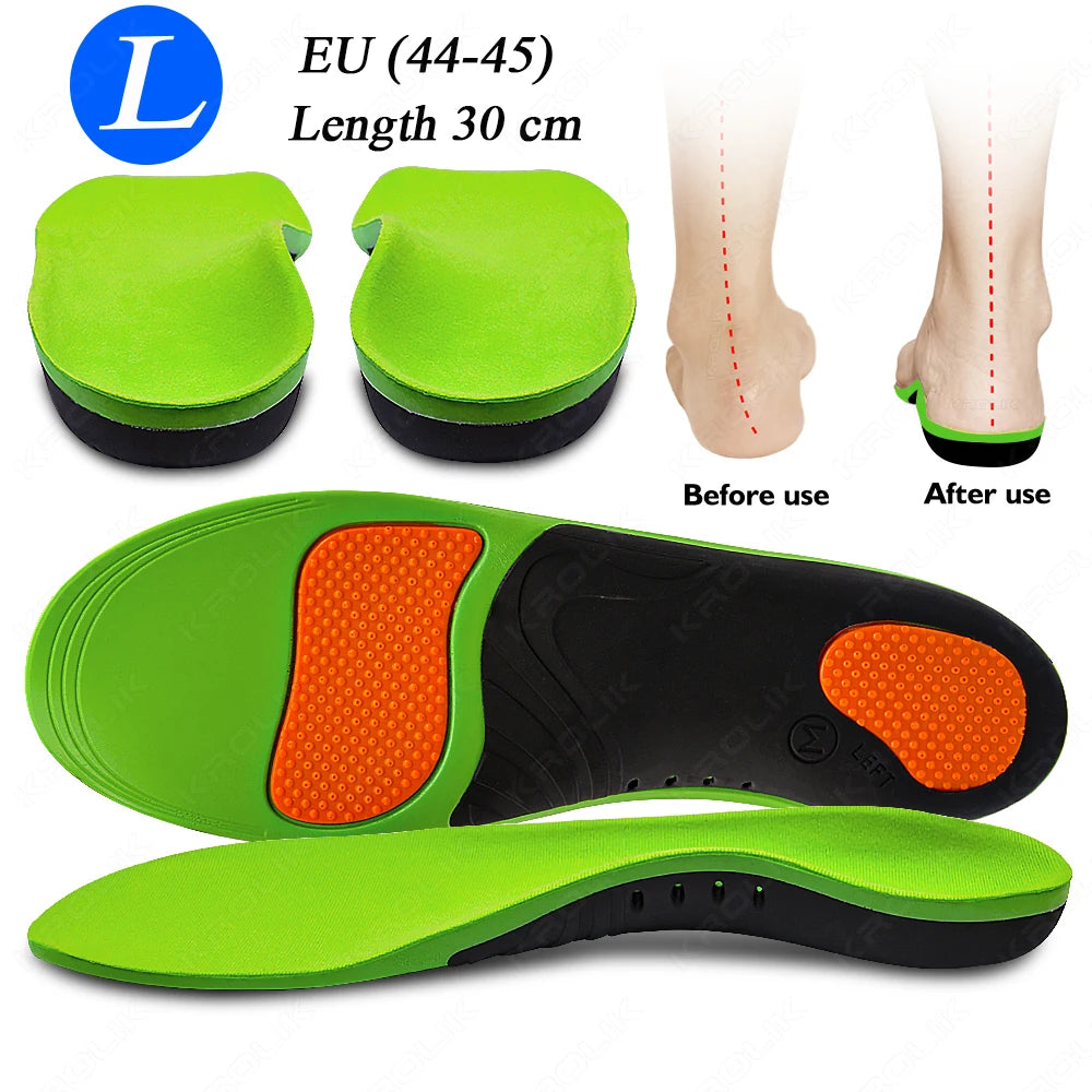 Flat Feet Arch Support X/O Legs Flat Foot Health Shoes Soles Pad Insoles Orthotic Insole for Plantar Fasciitis Orthopedic Unisex