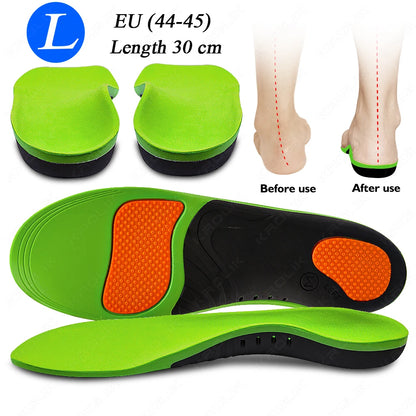 Flat Feet Arch Support X/O Legs Flat Foot Health Shoes Soles Pad Insoles Orthotic Insole for Plantar Fasciitis Orthopedic Unisex
