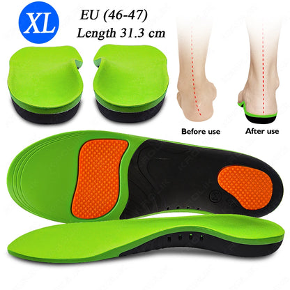 Flat Feet Arch Support X/O Legs Flat Foot Health Shoes Soles Pad Insoles Orthotic Insole for Plantar Fasciitis Orthopedic Unisex
