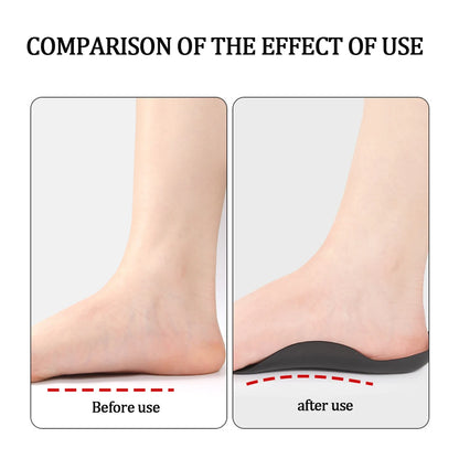 2PCS Arch Support | Half Arch Correct Insoles - Orthotic Shoe Insoles High Arch Support for Plantar (Black)